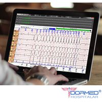 Holter Cardioscan 10 DMS