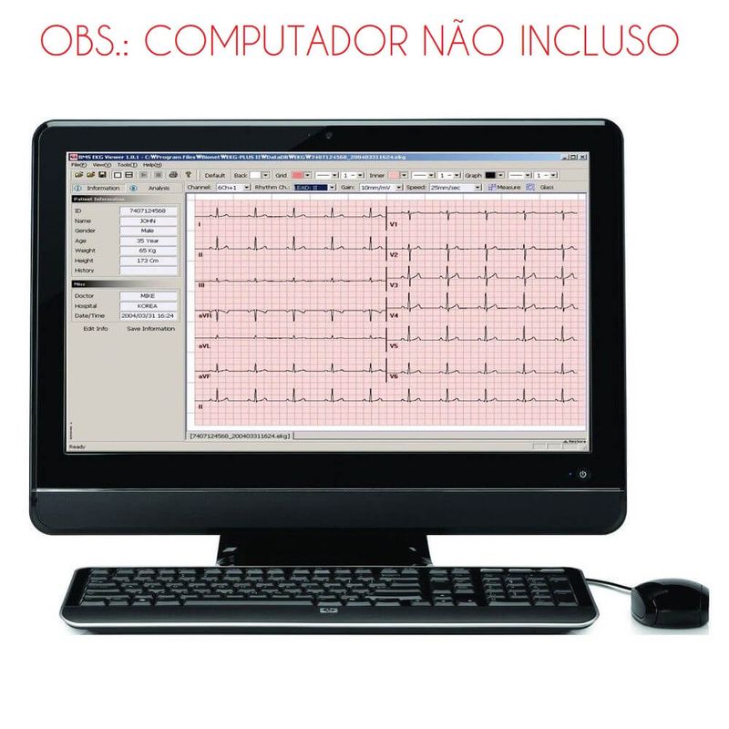 eletrocardiografo-cardiocare-2000-bionet-dormed-5