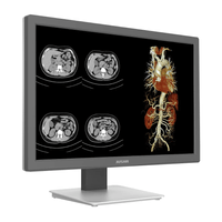 Monitor Diagnostico 24" Cr240g – Jusha