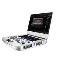 Ultrassom Portátil Acclarix AX3 - Edan