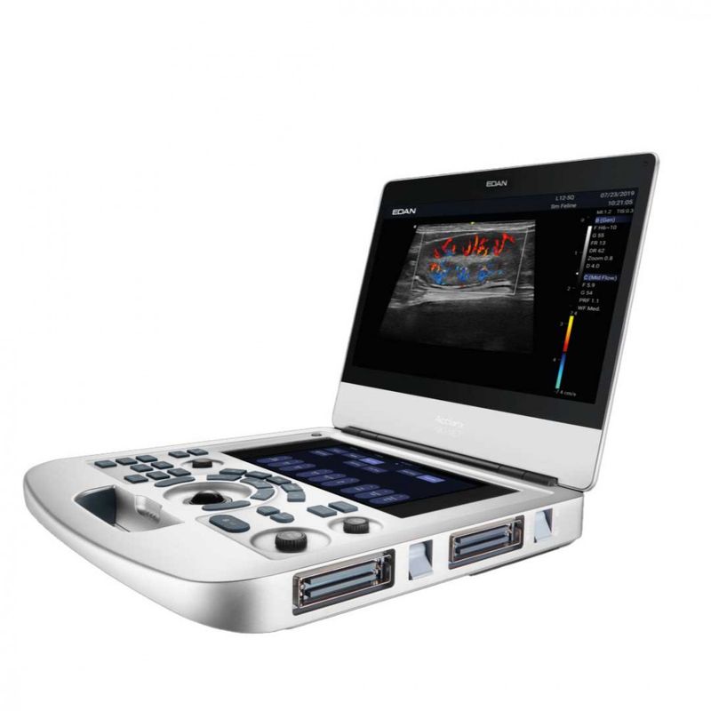 Ultrassom-Portatilc-AX3-Edan