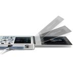ultrassom-ax3-edan-dormed-4