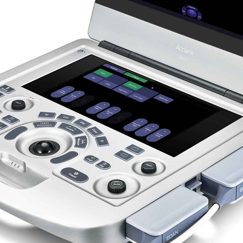 ultrassom-ax3-edan-dormed-9