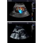 ultrassom-ax3-edan-dormed-14