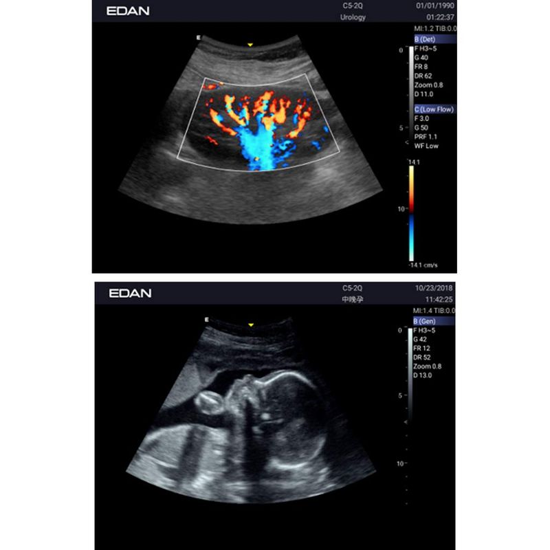 ultrassom-ax3-edan-dormed-14