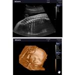 ultrassom-ax3-edan-dormed-15