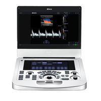 Ultrassom Portátil Acclarix AX2 - Edan