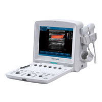 Ultrassom Portátil U50 - Edan