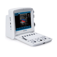 Ultrassom Portátil U50 - Edan