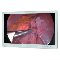 Monitor de Vídeo Grau Médico 27" MS270P - Argus